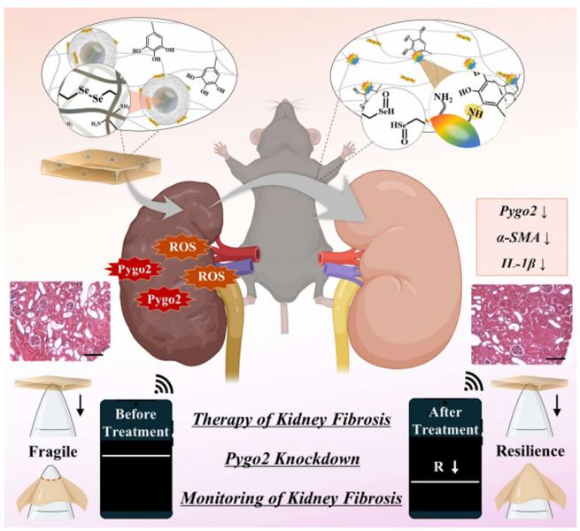 원광대 JABA대학원 진은정 교수 연구팀, 유전자 억제·환경 반응 결합한 신장 섬유화 치료 기술 제시