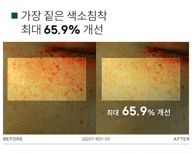 기사 대표 이미지